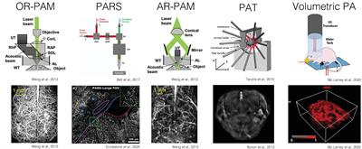 Photoacoustic Neuroimaging - Perspectives on a Maturing Imaging Technique and its Applications in Neuroscience